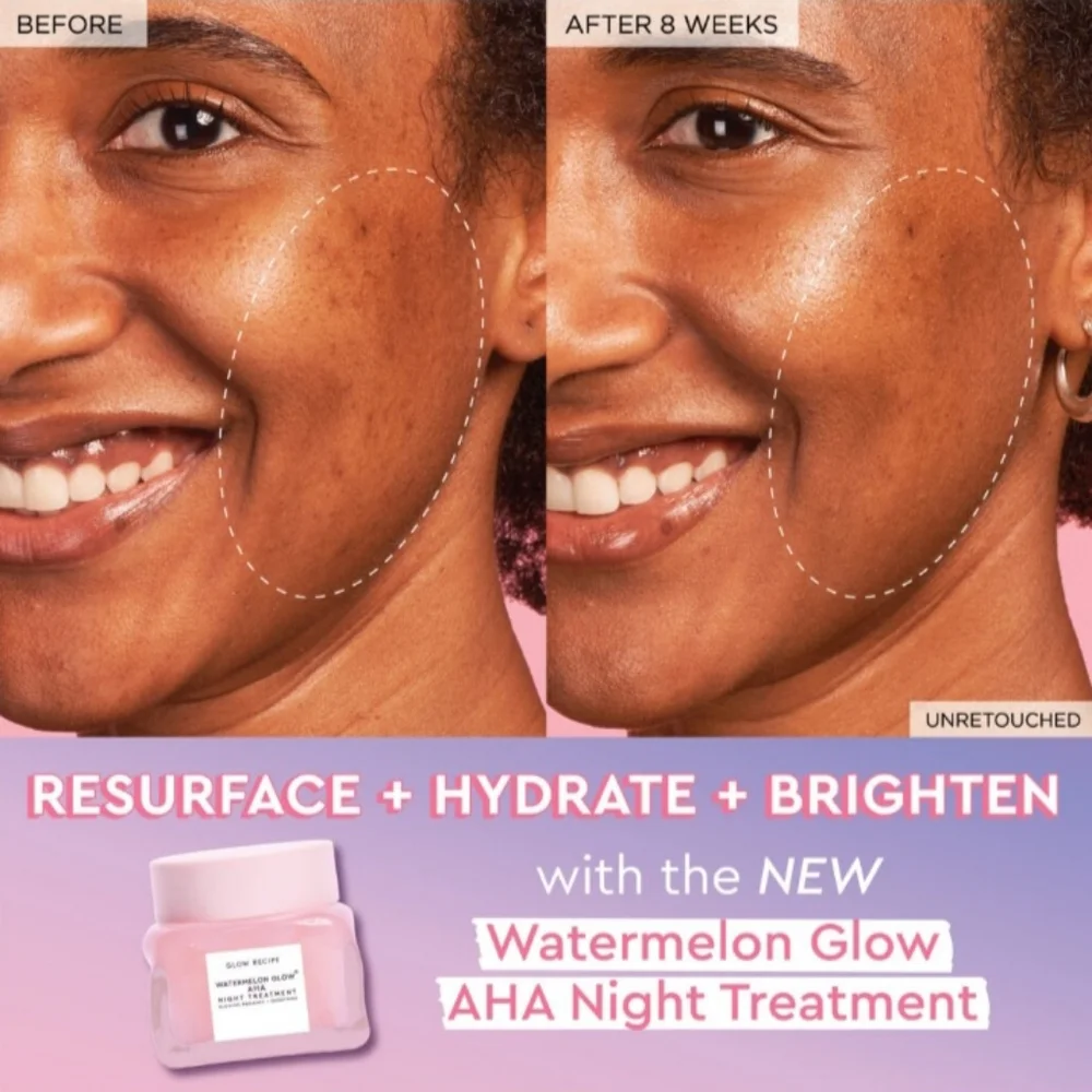 GLOW RECIPE Watermelon Glow AHA Night Treatment